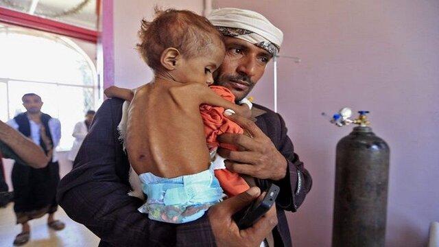 زنگ خطر سازمان ملل درباره بدترین بحران گرسنگی در یمن