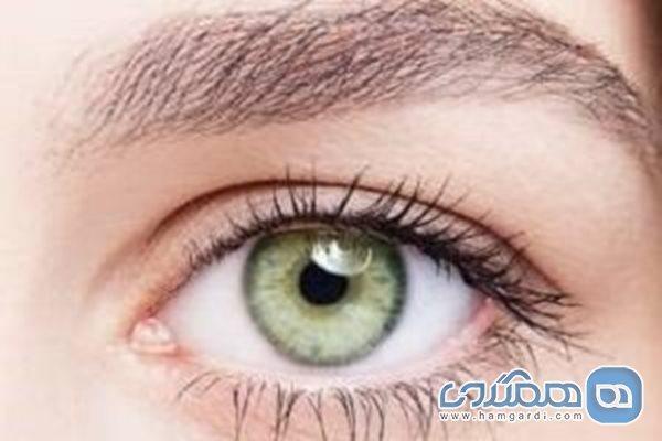 تشخیص کلسترول بالا از روی چشم ها